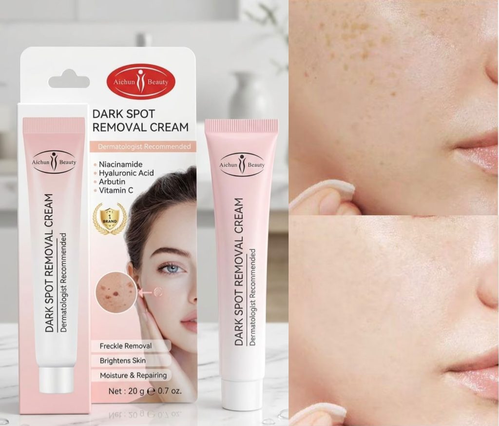 Dark Spot Removal Cream